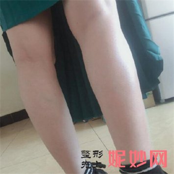 绵阳茗汇脱毛怎么样