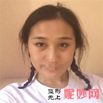绵阳茗汇医院热玛吉是正规的吗