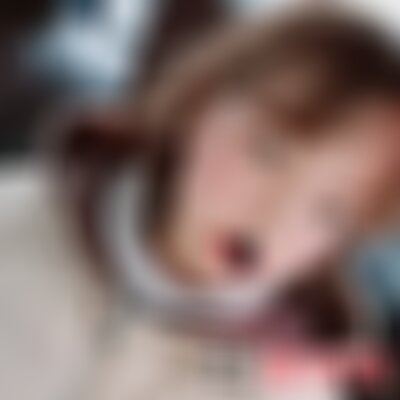 洛阳毛大夫光子嫩肤怎么样
