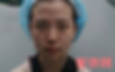 洛阳毛大夫线雕怎么样