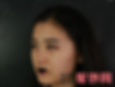 洛阳毛大夫整形医院瘦脸*多少钱