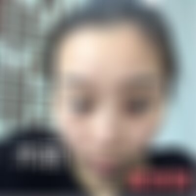 洛阳毛大夫鼻子缩小做得怎么样