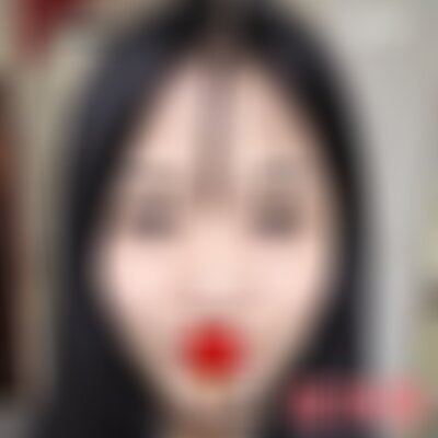 南充阿蓝医院激光祛痣好吗