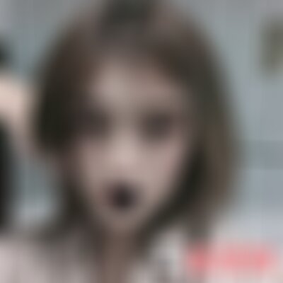 南充阿蓝医院做激光祛斑好吗