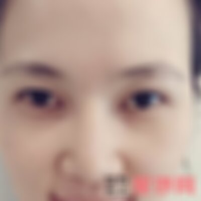 兰州皙妍丽整形医院纹眉案例