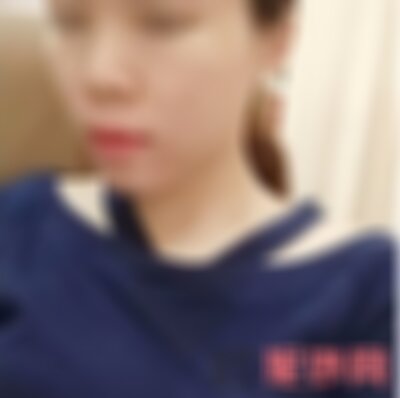 云南铜雀台治痘痘效果好吗