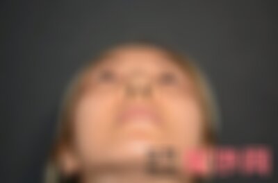 兰州皙妍丽鼻子谁做得好