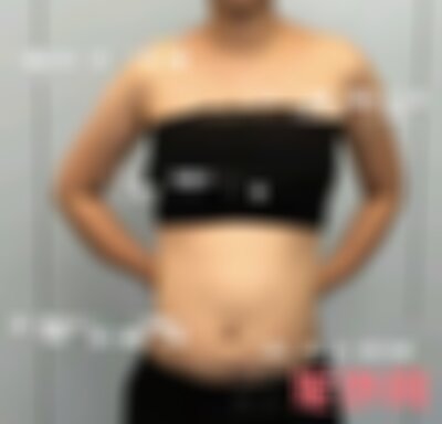 兰州皙妍丽隆胸怎么样