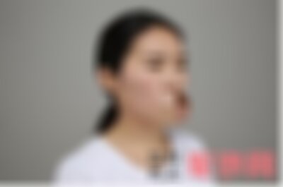 兰州皙妍丽整形医院双眼皮怎么样