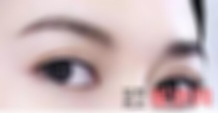 兰州皙妍丽整形医院双眼皮怎么样