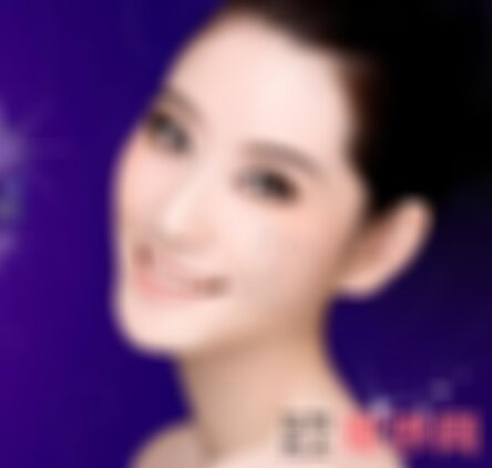 昆明梦想整形医院热玛吉怎么样