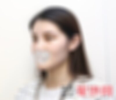 昆明梦想整形医院瘦脸*怎么样