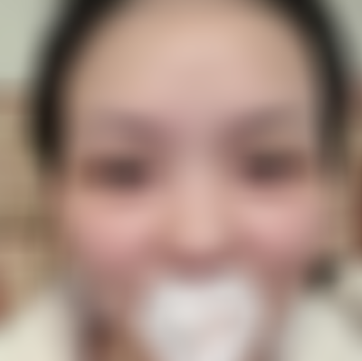 济南艺星祛斑怎么样