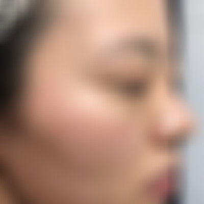 济南海峡整形医院祛斑怎么样