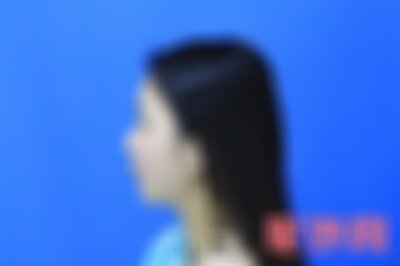 广州军美做鼻综合怎么样