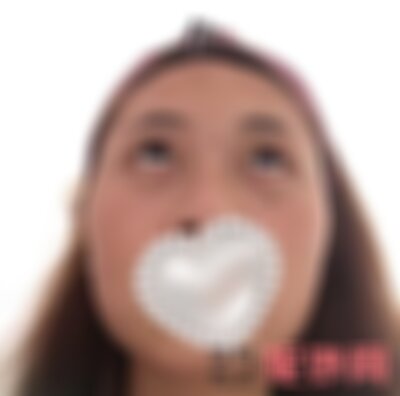 广州军美整形医院祛眼袋效果好不好