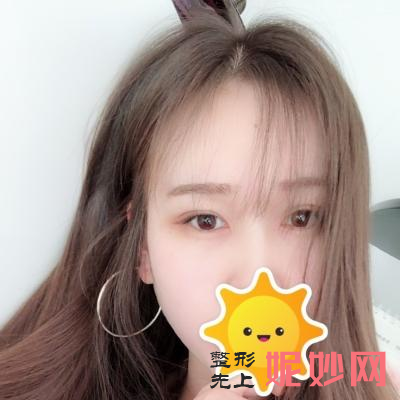 广州军美割的双眼皮怎么样