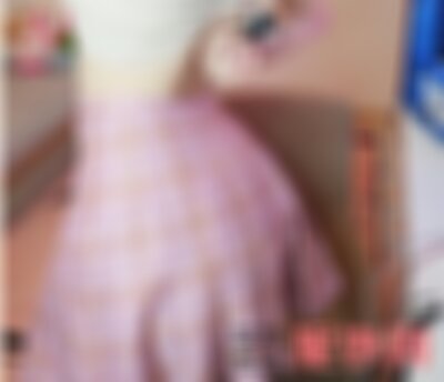 广州广大整形医院丰臀好不好