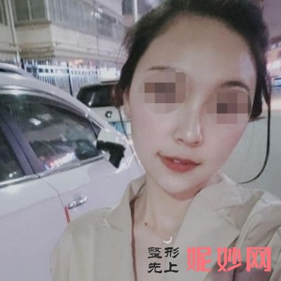 北京润美玉之光医院面部填充好吗