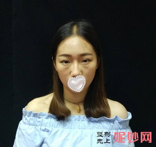 西京整形医院瘦脸看哪个医生