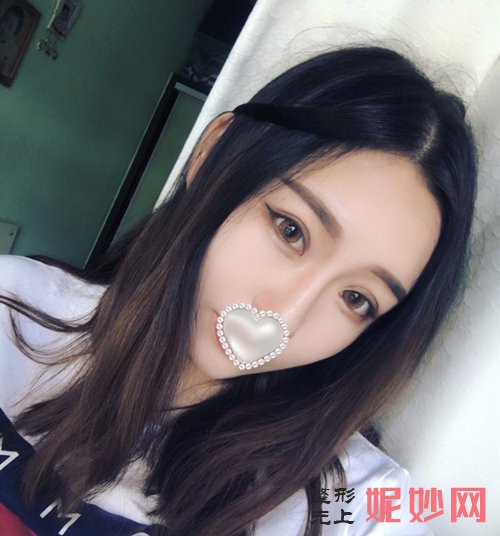 西京整形医院瘦脸看哪个医生