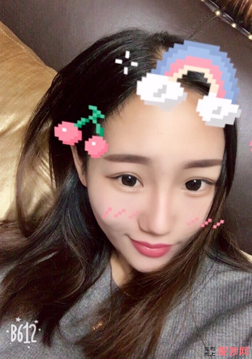 西京整形医院瘦脸看哪个医生