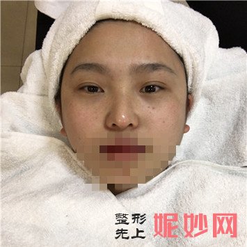 成都玉之光整形医院去斑怎么样