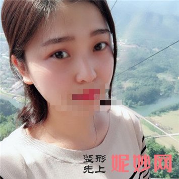 成都玉之光整形医院去斑怎么样
