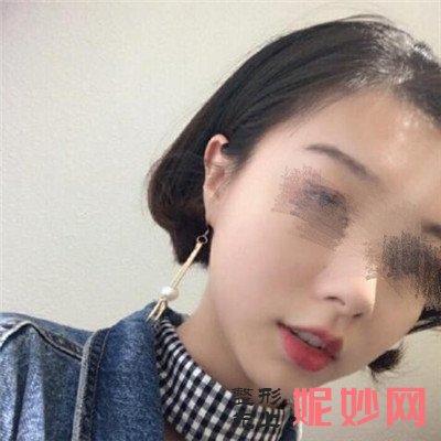 广州曙光医院玻尿酸多少钱
