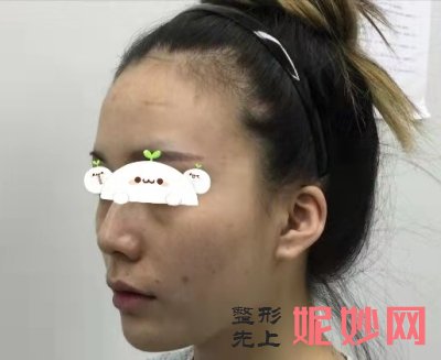 北京韩啸线雕效果怎么样