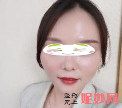 北京韩啸线雕效果怎么样
