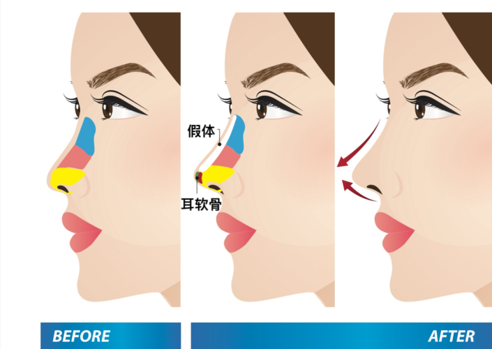 王佳琦