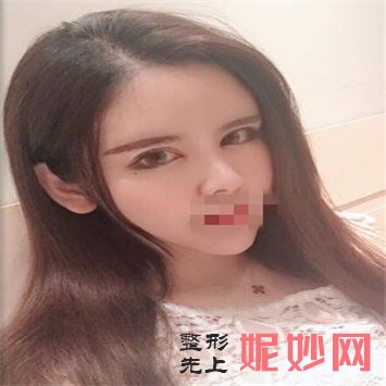 南京华美整形美容医院王小林做眼睛怎么样