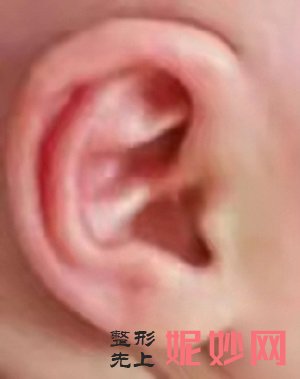 郑州耳畸形医院哪家好，这篇文章告诉你答案