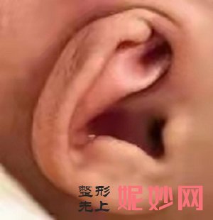 郑州耳畸形医院哪家好，这篇文章告诉你答案