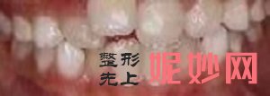 广州时光口腔侯振杰怎么样，口腔手术效果理想吗