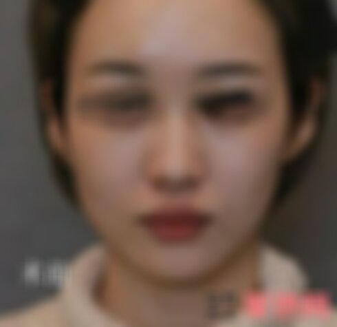 北京壹加壹隆鼻怎么样