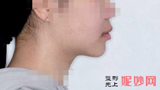 北大口腔医院较好把刀是哪位，做颌面整形好吗，附案例价格表！