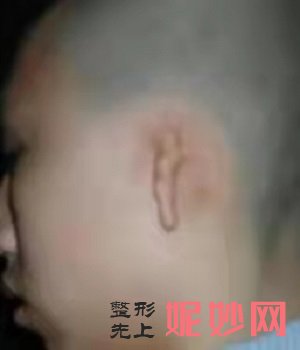 郑州耳畸形医院怎么样，地址，价格