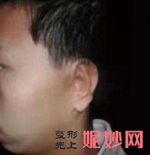 郑州耳畸形医院怎么样，地址，价格