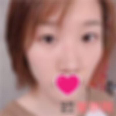 保定华美医疗美容医院去眼袋怎么样