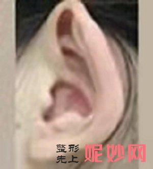 郑州小耳畸形整形医院怎么样，地址，价格