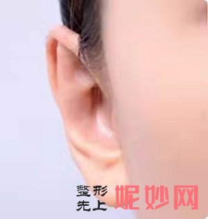 北京耳畸形矫正医院哪家好，这篇文章告诉你答案