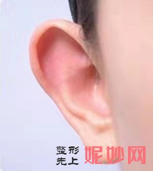 北京耳畸形矫正医院哪家好，这篇文章告诉你答案