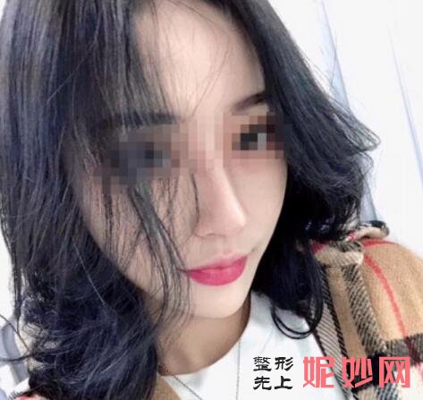 沈阳杏林整形外科医院隆下颌多少钱