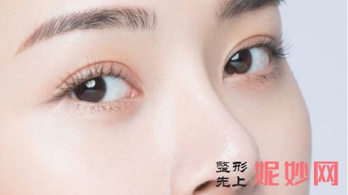 成都艺星整形医院双眼皮多少钱