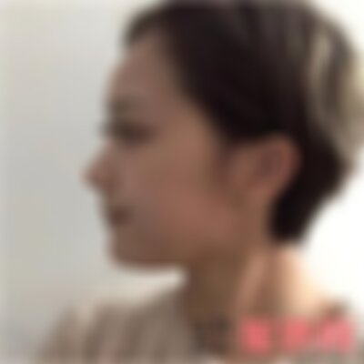 在保定华美童颜*价格是多少