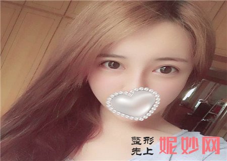 沈阳杏林美容整形医院皮秒多少钱