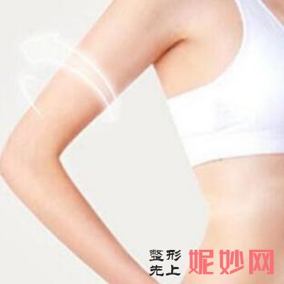 北京艺星医院脱毛便宜吗