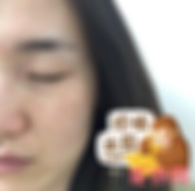成都晶肤超皮秒怎么样